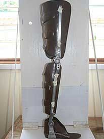 Alignment of the new orthosis