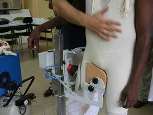 SIT Cast equipment and patient in correct casting position