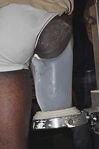 Socket fit